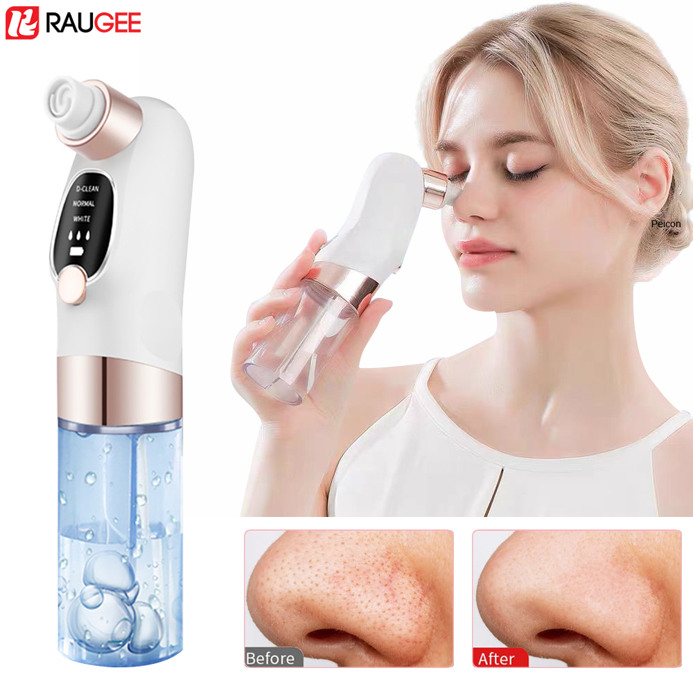 Blackhead Remover Electric Bla - đánh giá và giá Air Bubble Remover